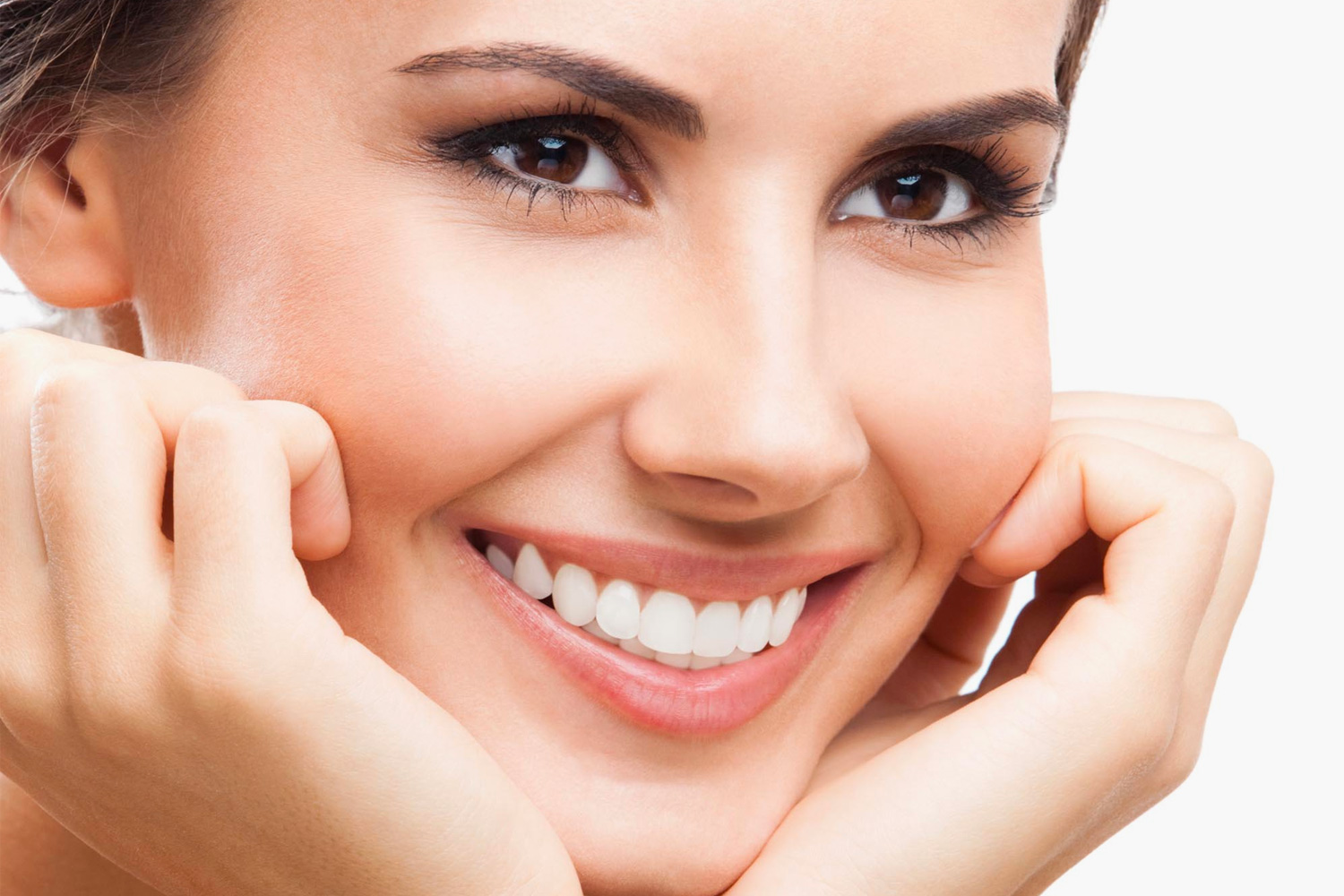 Veneers